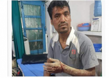 चितुवाको आक्रमणले घाइते