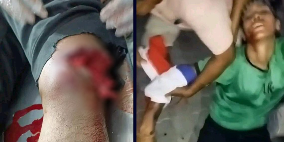 कोशी विरोधमा झापामा गोली चल्यो २ जना गम्भिर घाइते