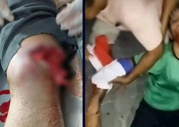 कोशी विरोधमा झापामा गोली चल्यो २ जना गम्भिर घाइते