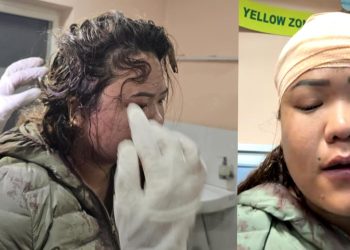 शर्मिला वाइबामाथि संघातिक हमला