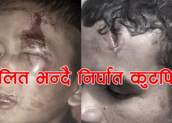 दलित भन्दै नाबालक माथि निर्घात कुटपिट
